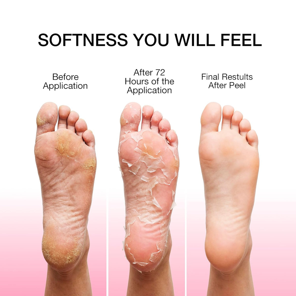 DEDOX Foot Peel Mask with Glycolic Acid – 50ml Pair | Exfoliating Foot Mask for Rough, Dry & Cracked Heels