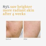 O3+ Skins Lutions Vitamin C Serum Glow- Face and Neck Serum 30ml - Image 3