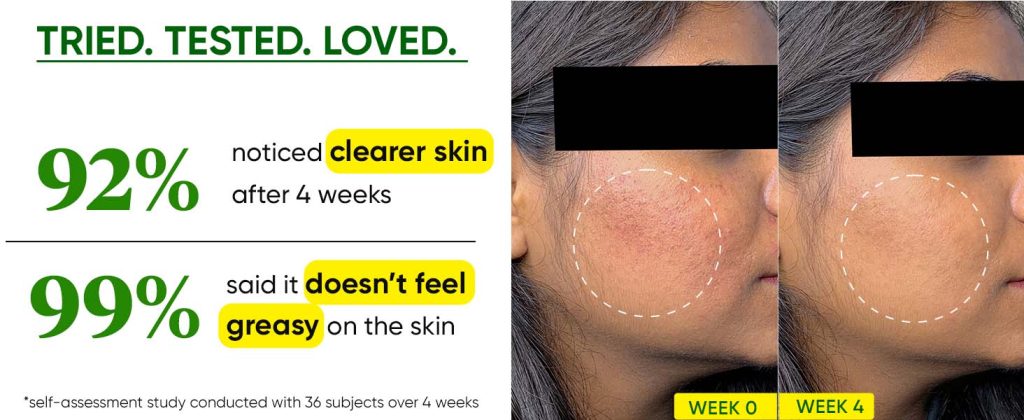 Dot & Key Niacinamide + CICA (Centella) Oil Free Moisturizer