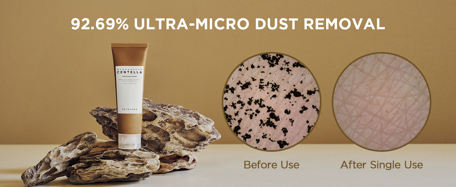 SKIN1004 Madagascar Centella Ampoule Foam, 125ml Korean Face Cleanser & Makeup Remover with Centella Asiatica, Gentle Daily Cleanser for Soft Skin, Korean Skin Care