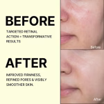 Celimax 0.1 percent retinal matrixyl niacinamide serum for wrinkles fine lines and firm skin