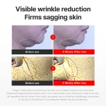 Centellian 24 Korean skincare Madeca cream for skin repair soothing and even tone