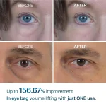 Dr Melaxin Eyephalt EGF eye cream for reducing wrinkles fine lines and puffiness