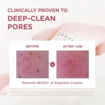 SKIN1004 Korean skincare deep pore cleansing foam for removing excess oil and impurities