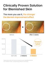 Celimax Korean pore minimizing serum for sensitive skin dark spots and healthy radiant skin care