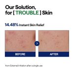 MEDIHEAL Korean calming face serum for daily skincare hydration care and healthy skin routine
