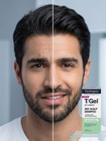 Neutrogena T Gel anti dandruff shampoo for oily scalp 250ml genuine scalp care product available at PinkBliss India