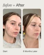 Topicals Faded clearing serum for discoloration care post blemish marks and smoother skin appearance